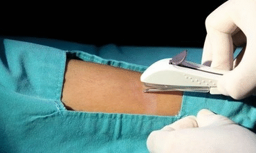 Myom Tanısı, Takibi ve Tedavisi