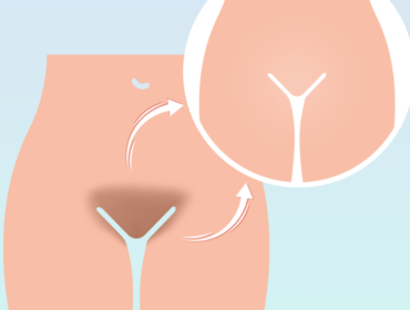 Vajinal Estetik Neden Tercih Edilir? Vajinal Estetik Neden Tercih Edilir?